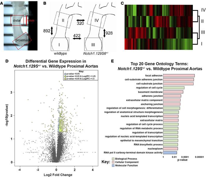RNA sequencing reveals gene expression changes in Notch1.129S6+/– aortic...