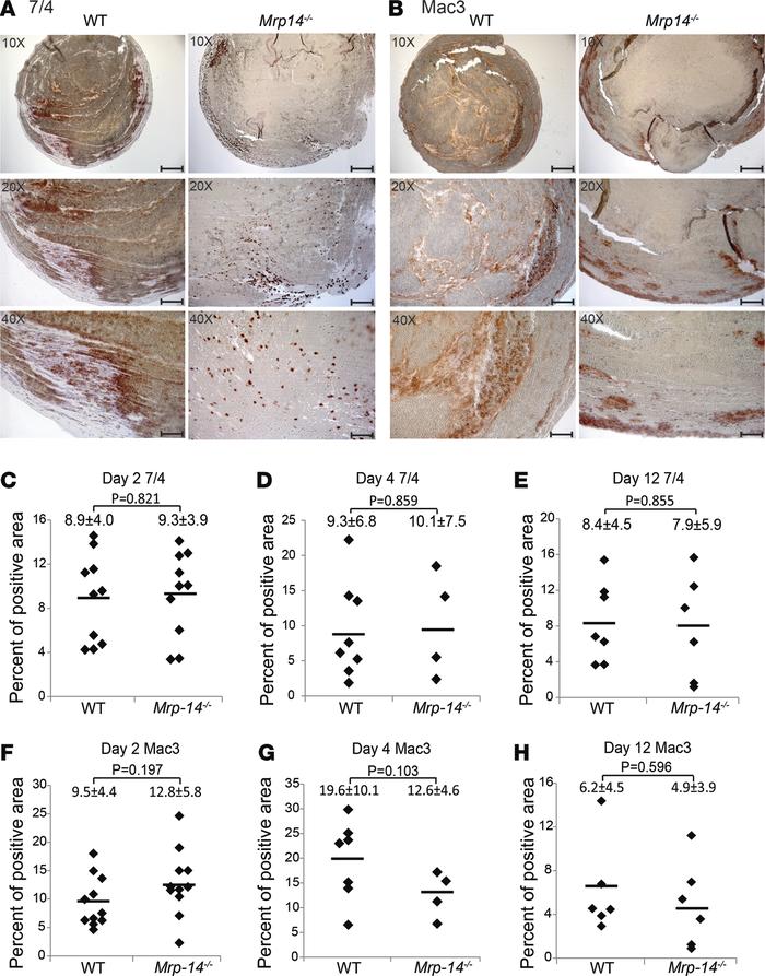 The accumulation of inflammatory cells is unimpaired in Mrp-14-/- thromb...