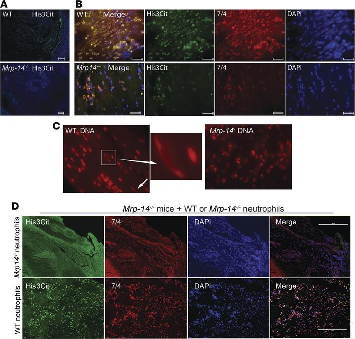 NET formation is defective in Mrp-14-/- mice.
(A) Representative immunof...