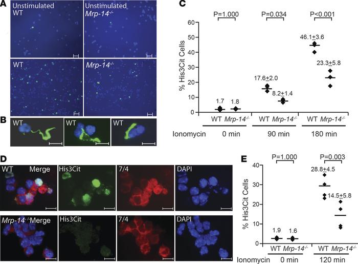 In vitro NETosis in WT and Mrp-14-/- neutrophils.
(A) Representative ima...