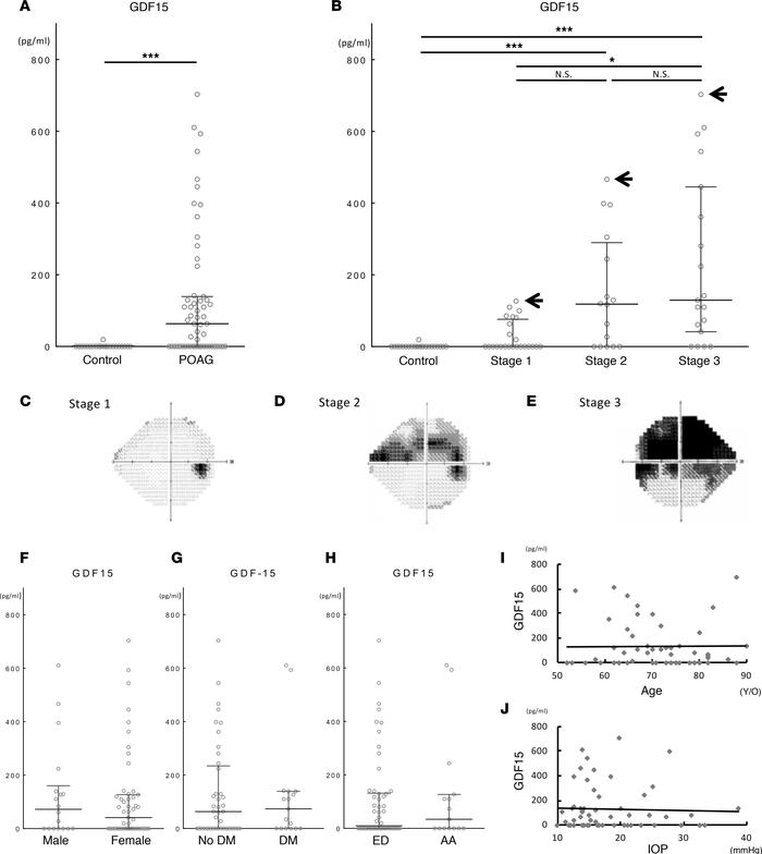 Elevated GDF15 level in aqueous humor (AH) of primary open angle glaucom...