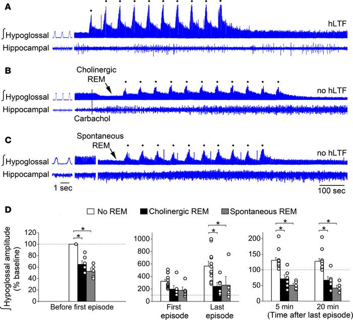 Obstructive apnea–induced hLTF was depressed during REM sleep.
(A) Obstr...