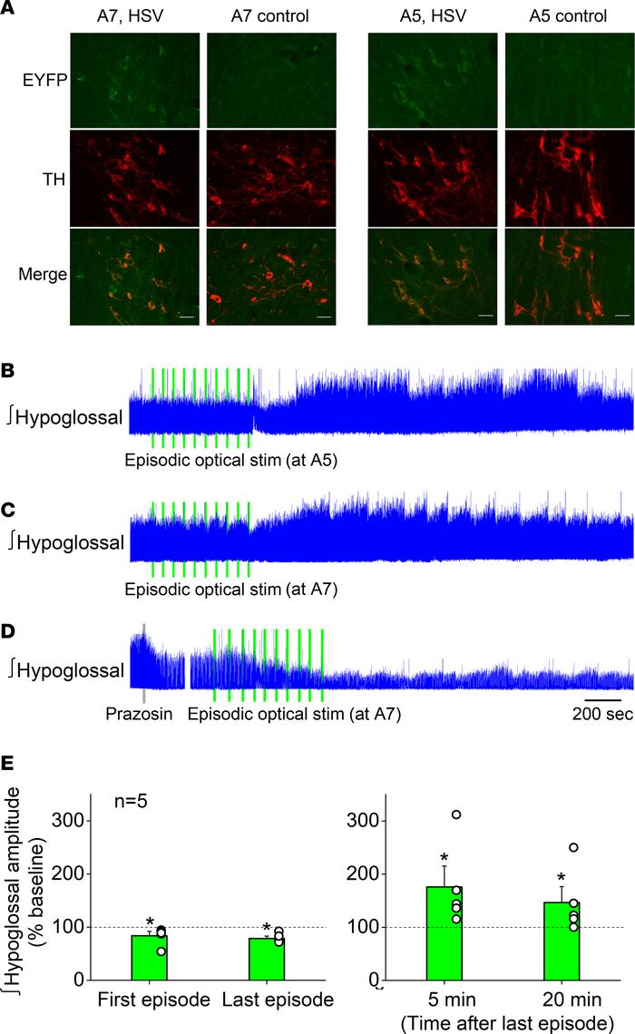 Episodic optogenetic stimulation at the A7 or A5 regions induced hLTF af...