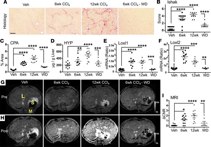 Gd-Hyd–enhanced MRI of hepatic fibrosis progression and regression.
Mice...