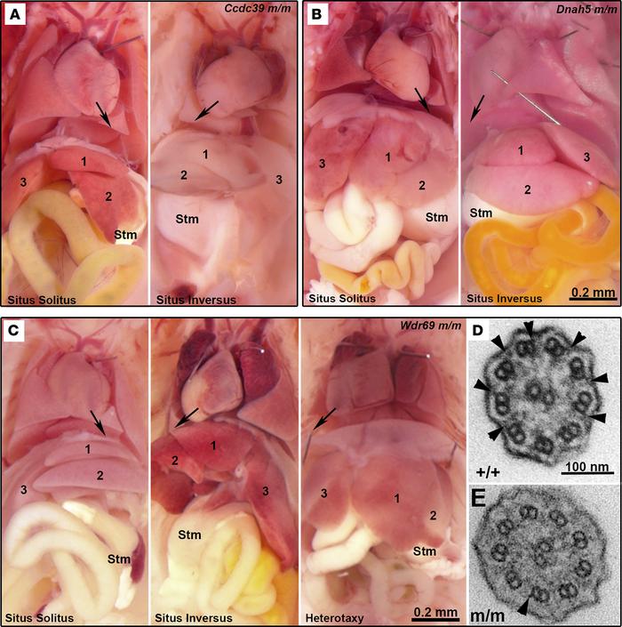 Pathological characterization of PCD mice.
(A) Representative pathologic...