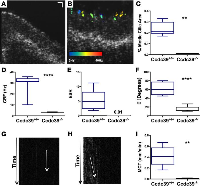Characterization of Ccdc39–/– mice.
(A) Representative motile cilia area...