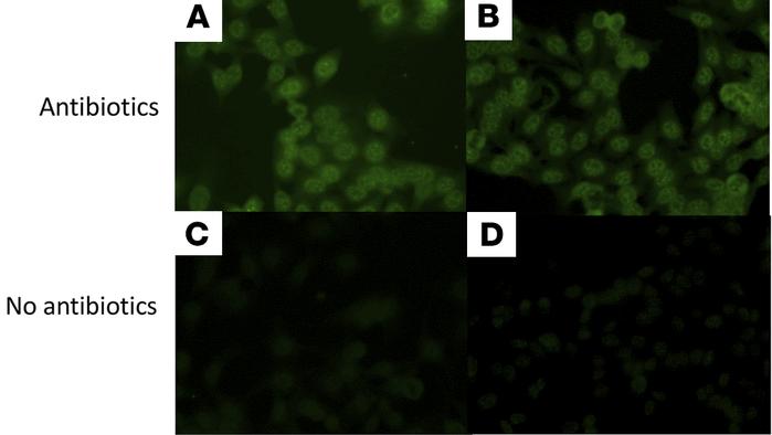 Antinuclear antibodies (ANAs) in humanized mice treated with antibiotics...
