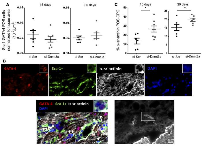 Downregulation of Dnmt3a in cardiac progenitor cells injected in infarct...