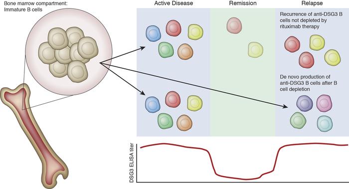 Potential mechanisms of disease relapse after B cell depletion therapy.
...