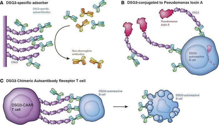 Autoantigen-based targeted therapies in pemphigus.
Select strategies are...