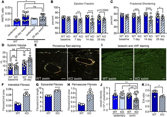 MT1/2 deficiency leads to exercise intolerance and cardiac dysfunction.
...