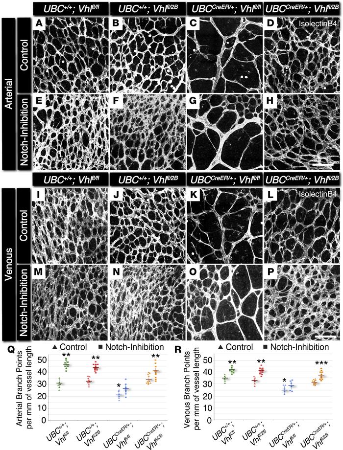 Conditional loss of Vhl in P7 mouse retinas yields a reduction in arteri...