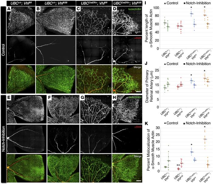 In P7 mouse retina, conditional Vhl-null and –type 2B mutations accelera...