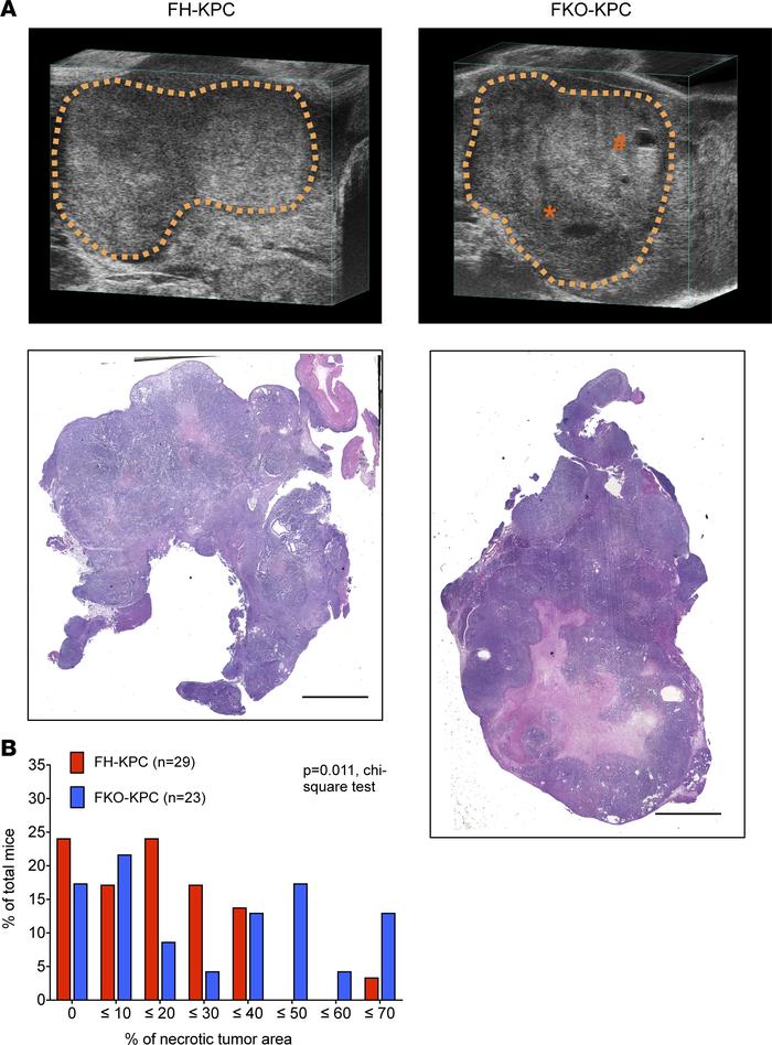 Targeting FAP alters internal tumor architecture associated with necroti...
