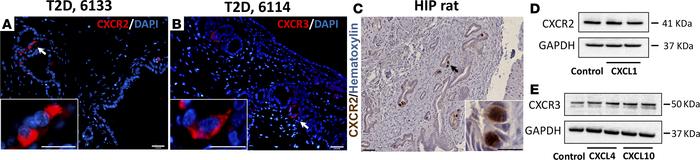 The chemokine receptors are expressed in pancreatic duct glands (PDGs) a...
