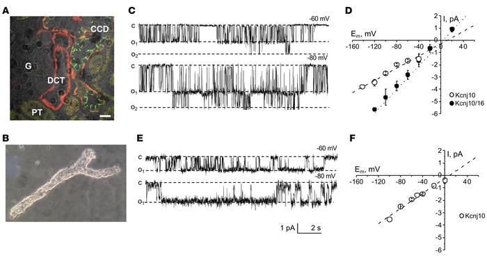 Electrophysiological analysis of Kir4.1 homotetrameric and Kir4.1/Kir5.1...
