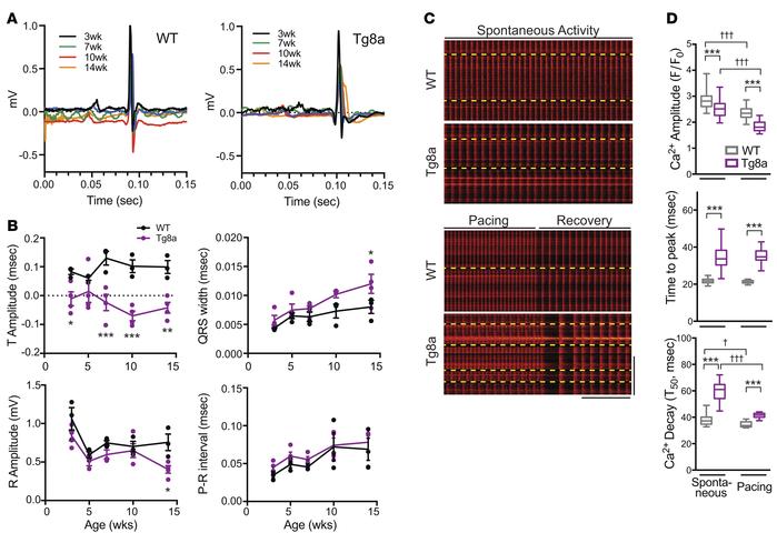 Cdk8 overexpression induces cardiac conduction defects and cardiomyocyte...