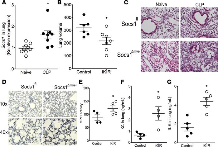 SOCS1 inhibits lung injury during sepsis.
(A) Socs1 expression in the lu...