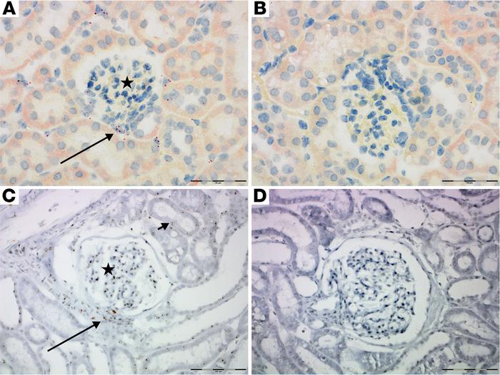 GPR81 expression is associated with the microvasculature of the kidney.
...