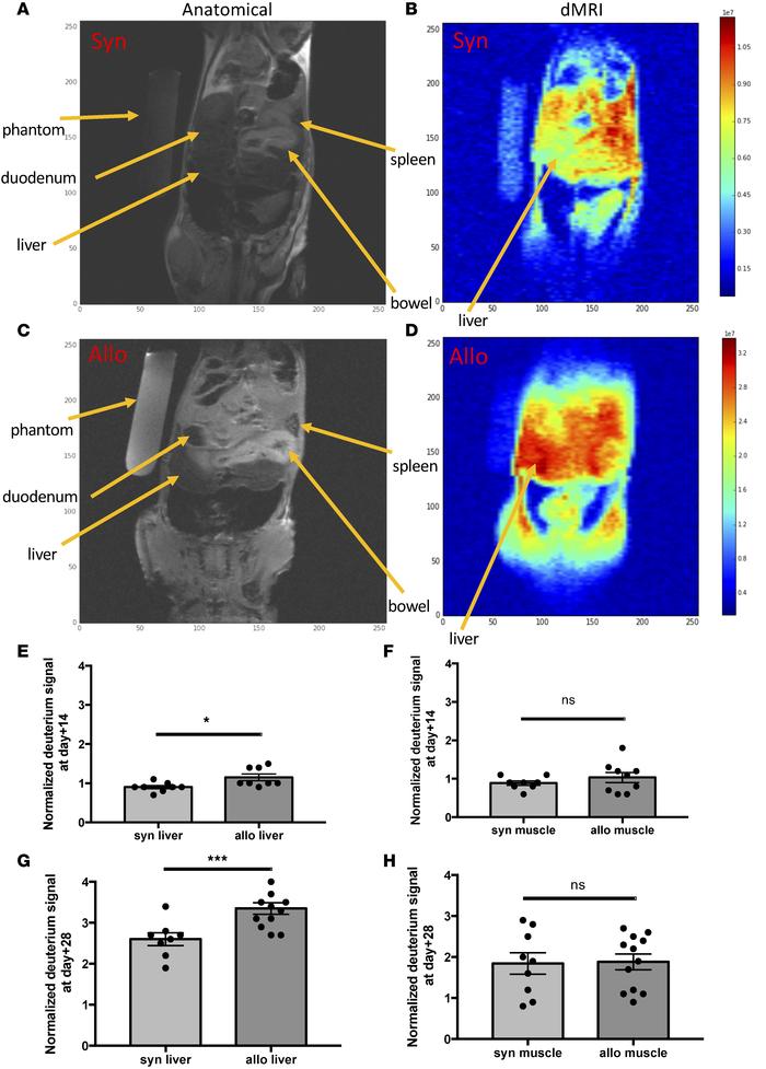 In vivo deuterium labeling followed by deuterium MRI (dMRI) facilitates ...