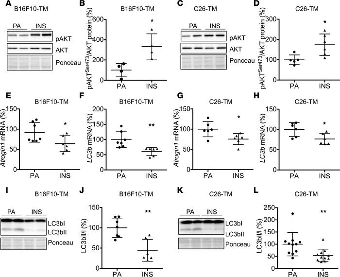 Chronic insulin supplementation attenuates atrophy and autophagy in adva...