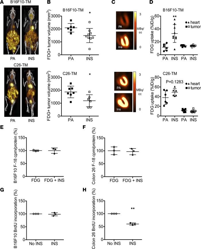 Chronic insulin supplementation attenuates metabolic impairment and meta...