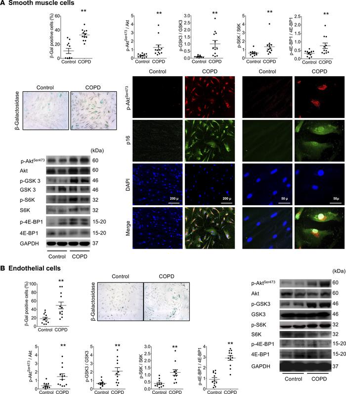 Analysis of cultured cells from patients with COPD and controls.
(A) Per...