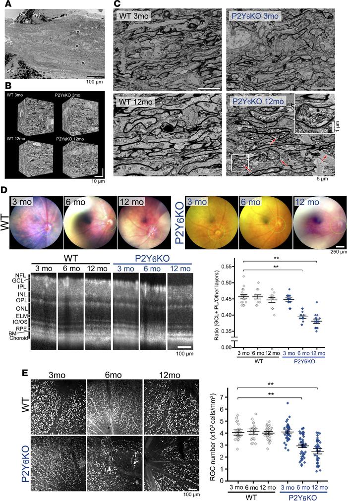 Histological changes in P2Y6KO mice.
(A) Serial block-face scanning elec...