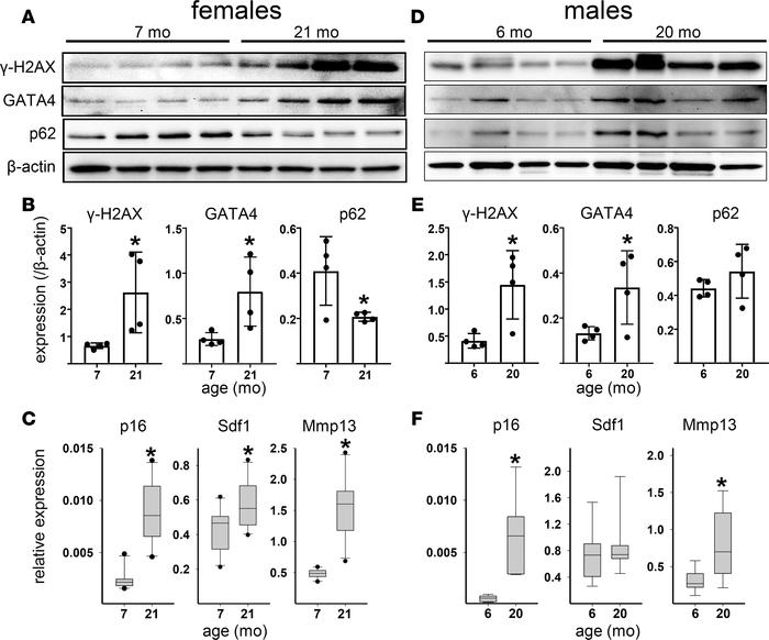 Osteocyte-enriched bone from aged mice exhibits markers of cellular sene...