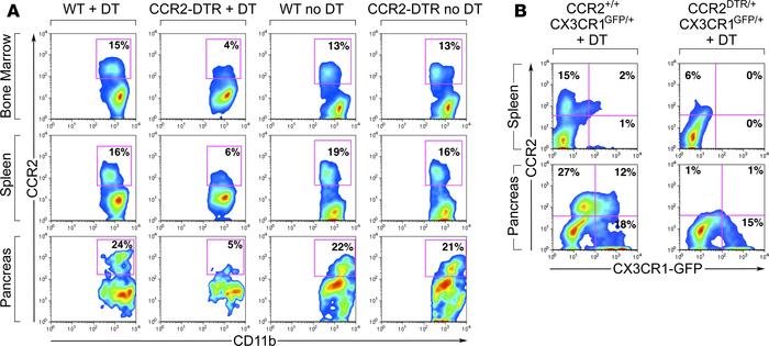 Quantitative analysis of leukocyte subsets in BM, splenic, and pancreati...
