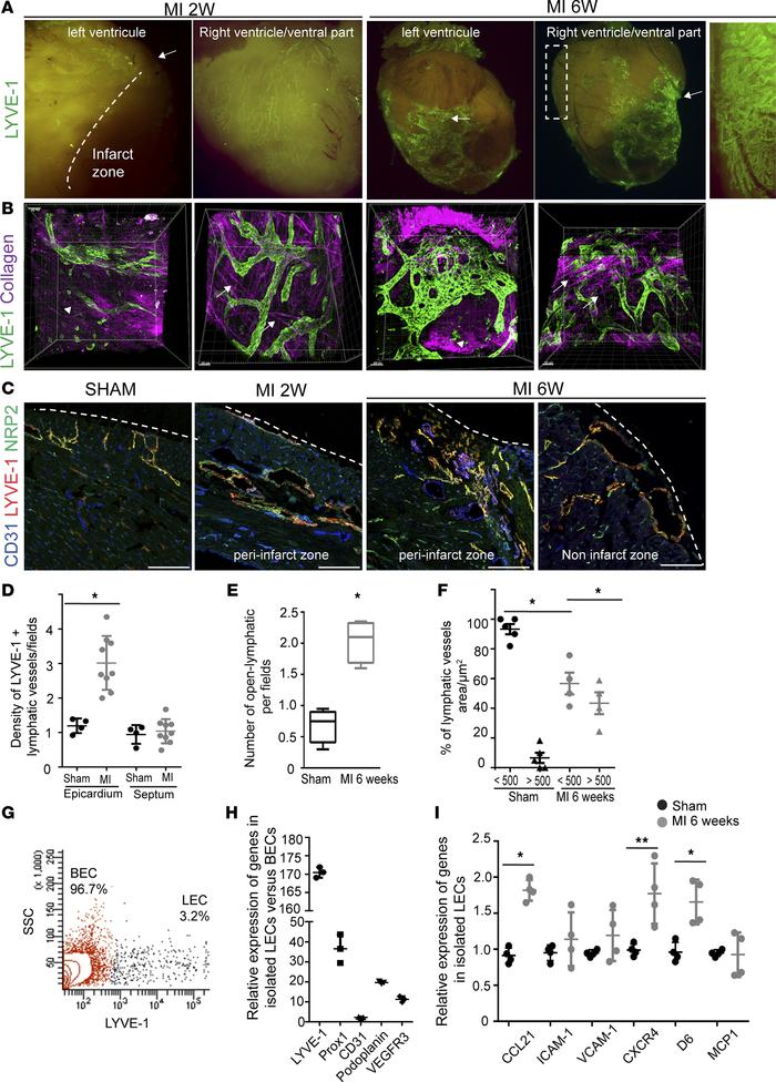 Chronic myocardial ischemia induces pathological remodeling of lymphatic...