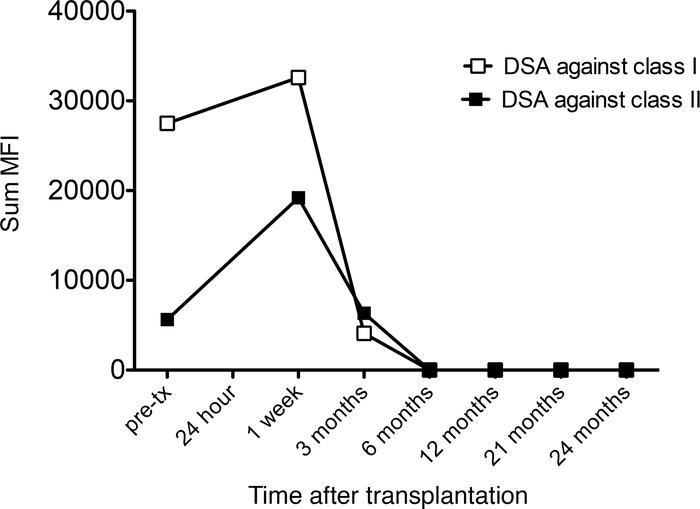 Sum mean fluorescence intensity of circulating donor-specific antibodies...