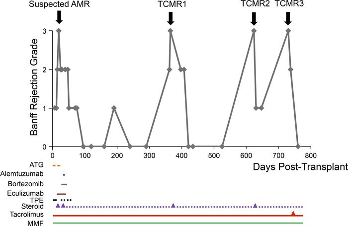 Banff histological grades of rejection for facial allograft biopsies and...