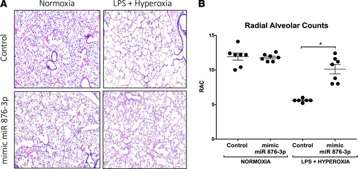 Mimic miR 876-3p rescues alveolarization in murine BPD: Proteobacterial ...