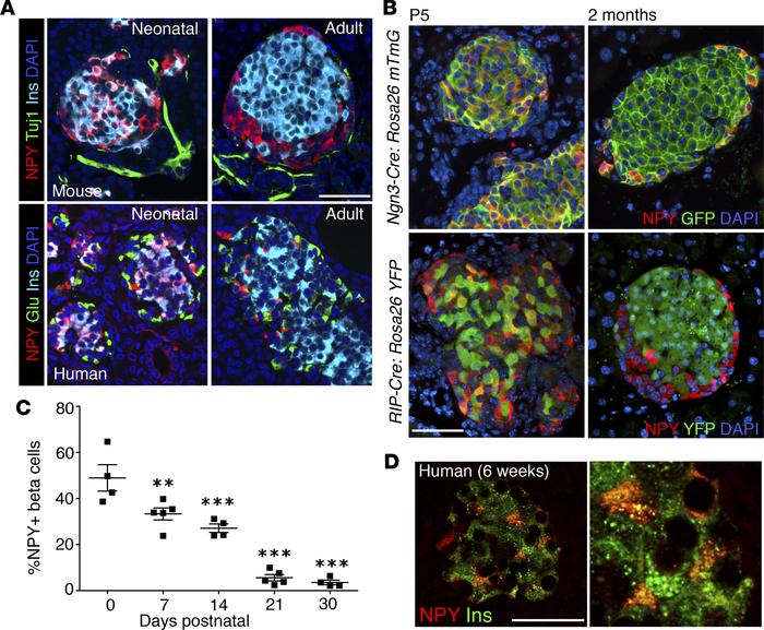JCI Insight - Neuropeptide Y expression marks partially differentiated ...