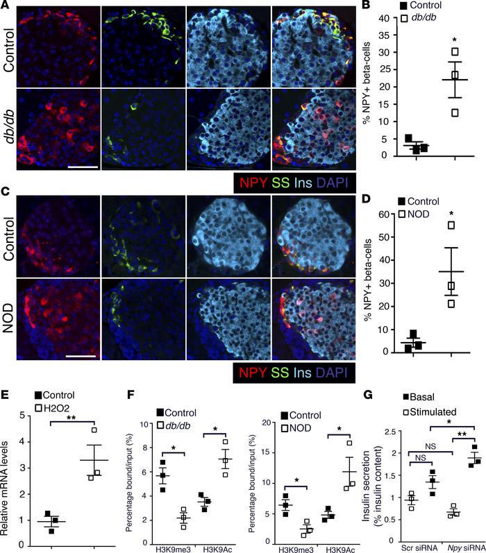 NPY is reexpressed in the β cells preceding disease onset in mouse model...
