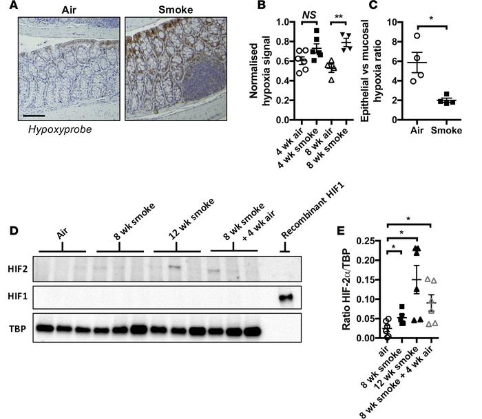 Chronic CS exposure triggers mucosal hypoxia and HIF-2 stabilization.
(A...