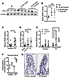 Serum VEGF is elevated in mice chronically exposed to CS and in current and