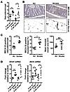 Chronic CS exposure drives vascularization and VEGF expression.