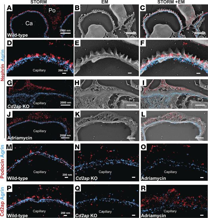 STORM and STORM-EM correlative imaging of slit diaphragm molecules in he...