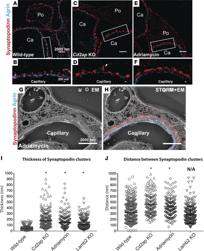 Spatial distribution of synaptopodin after podocyte injury.
(A–F) Double...