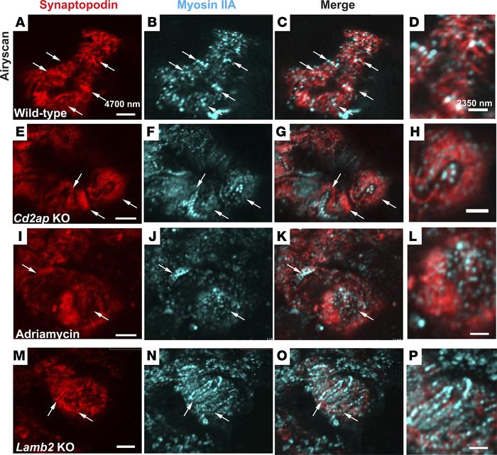 Direct en face imaging of podocyte foot processes.
En face views of the ...