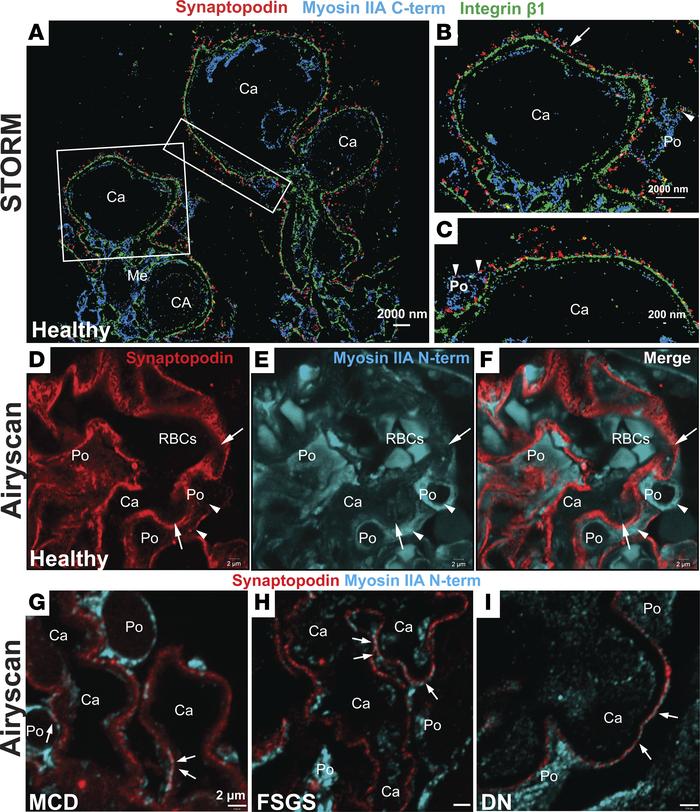 Myosin IIA is present in the human podocyte cell body and major processe...