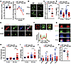 DOCK8-deficient Tregs have abnormal shape and F-actin kinetics and an unsta