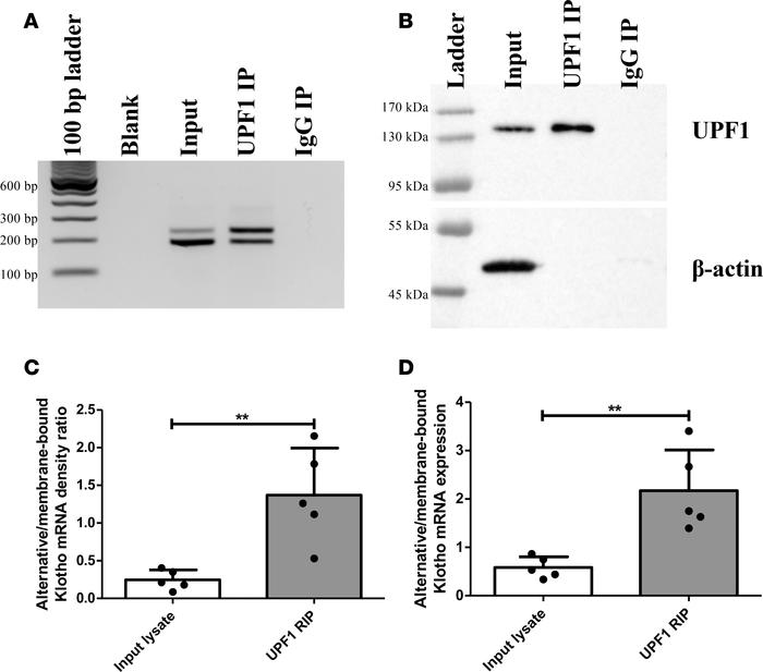 RNA IP of HK-2 cell lysate reveals enrichment of the alternative Klotho ...