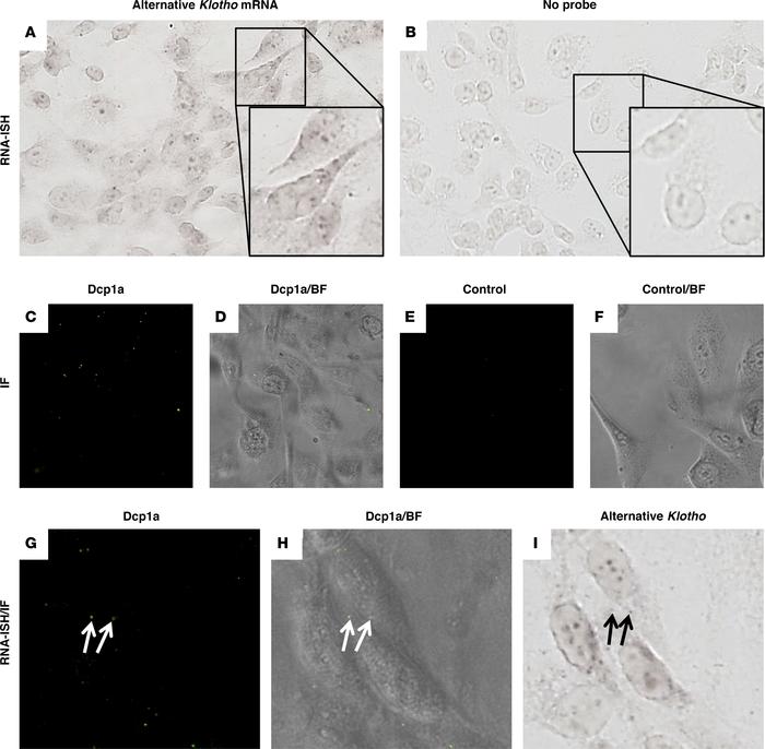 RNA in situ hybdridization for the alternative Klotho mRNA transcript in...