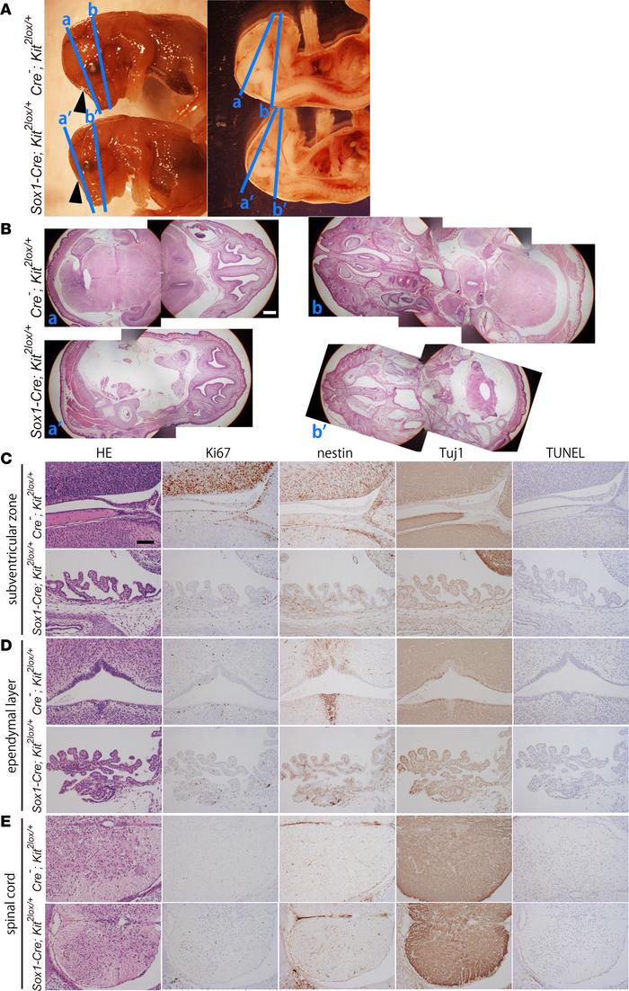 Histological characterization of the E15.5 Sox1-Cre; Kit2lox/+ embryos.
...