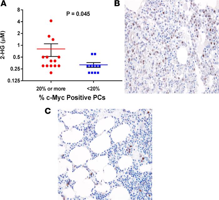 c-Myc expression in BM plasma cells correlates with 2-HG levels in the B...