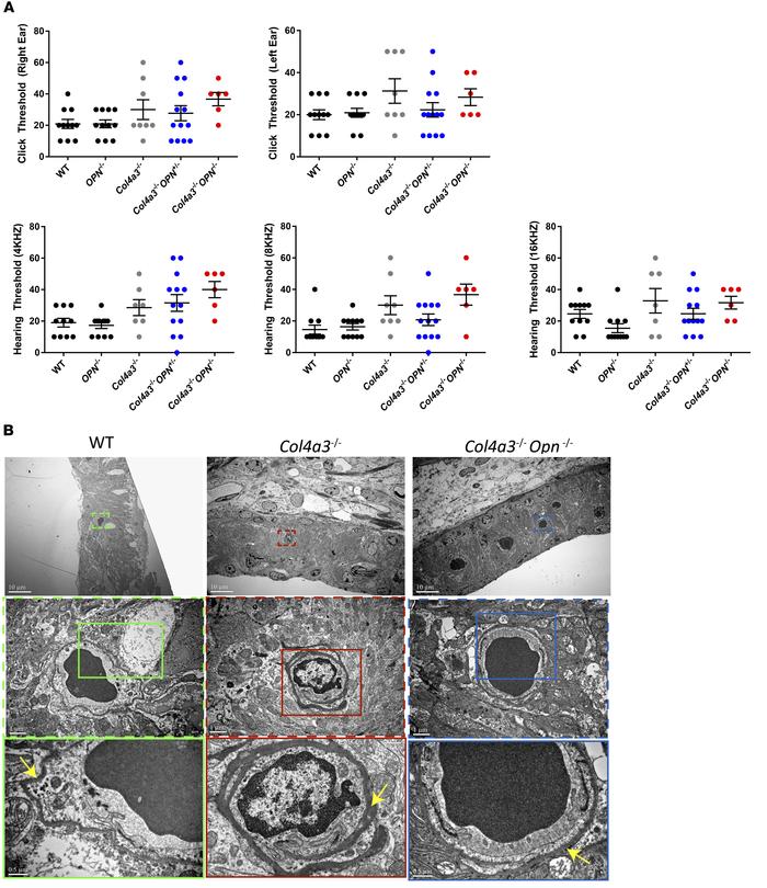 OPN deficiency tends to improve high-frequency hearing threshold in Col4...