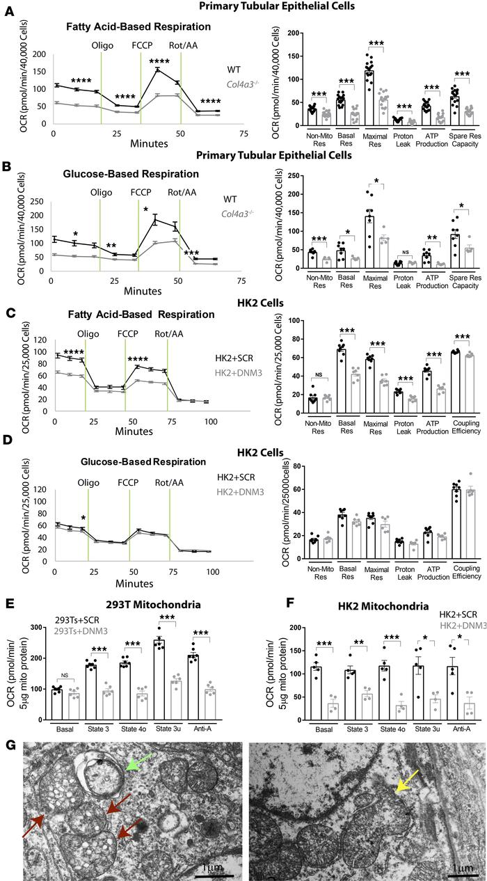 Seahorse assay reveals defective mitochondrial respiration in DNM3-overe...